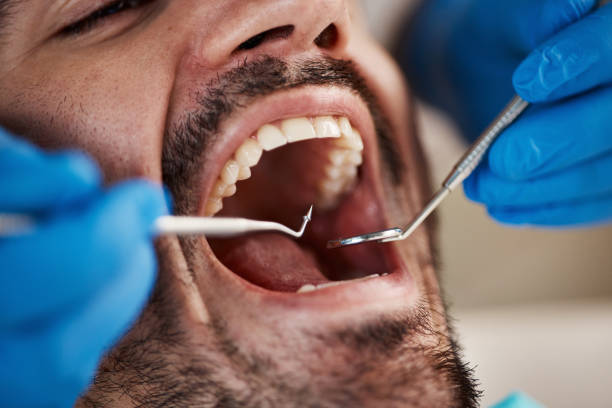 Best After-Hours Dental Trauma Care in Troy, AL